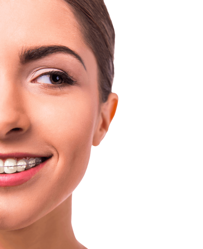 The straight scoop: Choosing between traditional braces and Invisalign «  Smiles by White