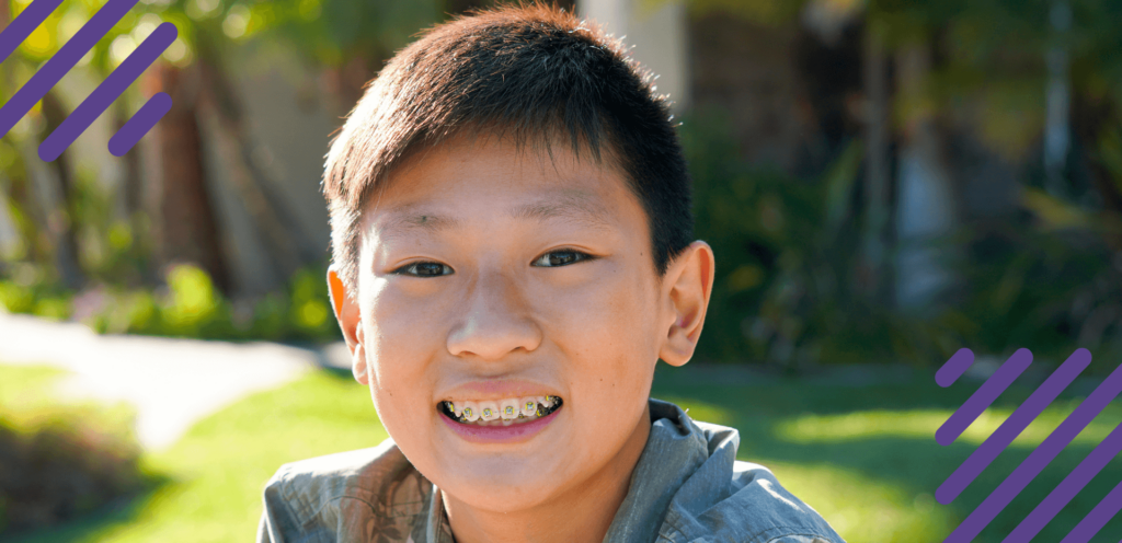How to Get Braces Conclusion - Boy with braces smiling outside