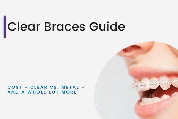 Clear Braces Guide - Dickerson Orthodontics