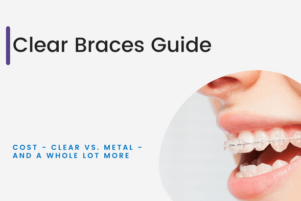 Clear Ceramic Braces 2023  Clear Braces vs. Metal Braces