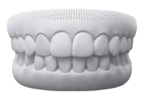 digital smile of perfect permanent teeth after orthodontic treatment to correct an overbite